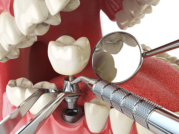 Best Emergency Treatment for Toothache in Siloam Springs, AR