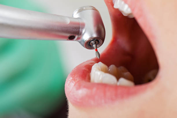 Best Emergency Treatment for Toothache in Siloam Springs, AR